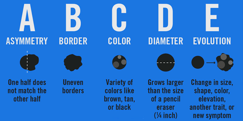 ABCDE's of Melanoma  Skin Cancer And Reconstructive Surgery Center