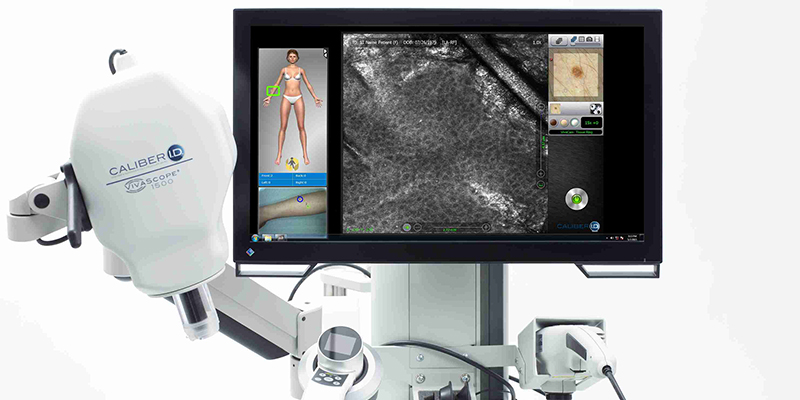 Skin Cancer Diagnosis with Reflectance Confocal Microscopy