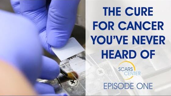 Mohs Surgery – Episode 1